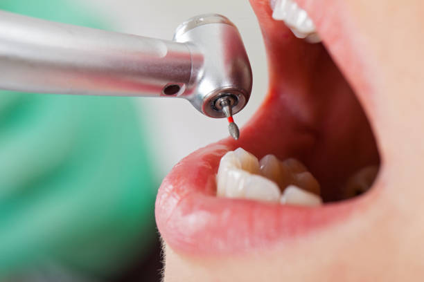 Best Cosmetic Emergency Dentistry in Surfside Beach, SC